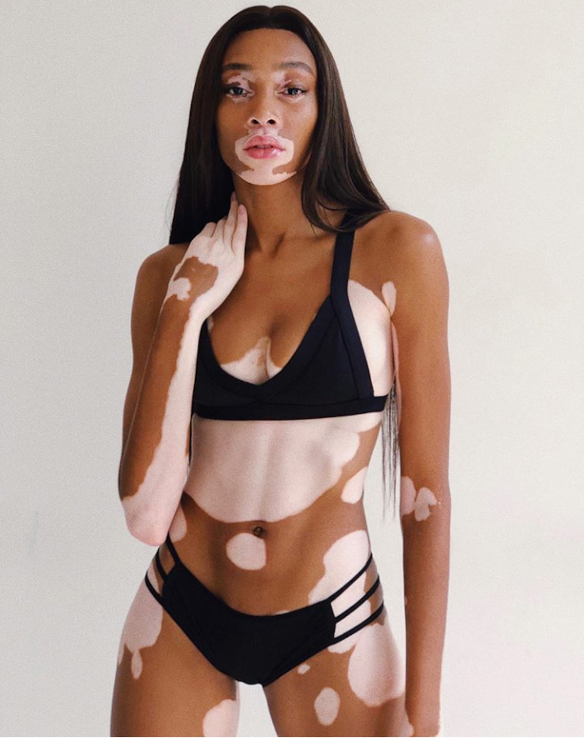 Winnie Harlow, la modelo con vitiligo que desfilará para Victoria’s Secret